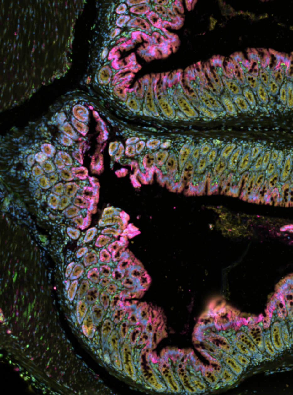 Spatial transcriptomics seminar with 10x Genomics