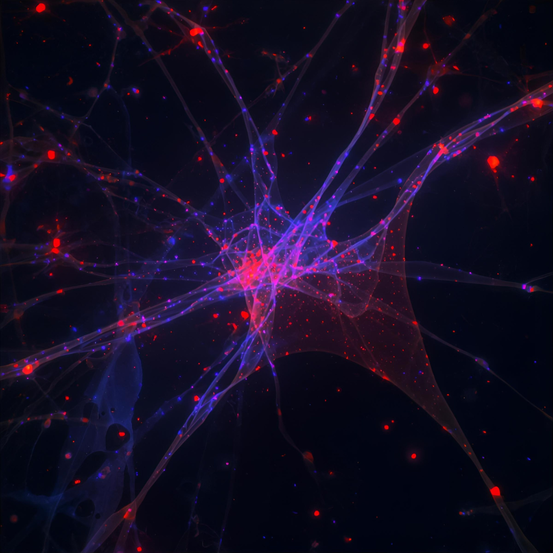 Fluorescence microscopy image of neuronal cells