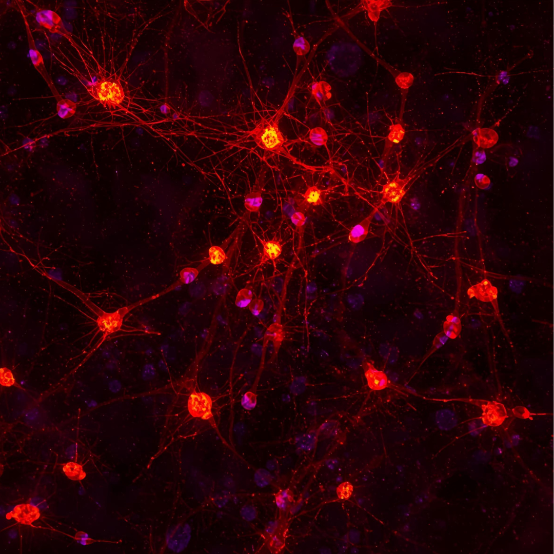Astrocytes and neuroinflammation